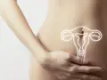 Kobieta trzyma dłoń na brzuchu, na którym widnieje rysunek macicy. Czy po usunięciu macicy się tyje?