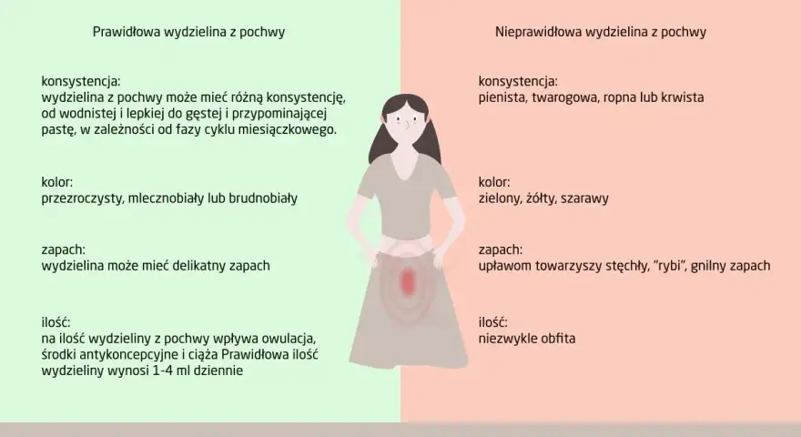 Prawidłowa wydzielina z pochwy jest wodnista lub gęsta, bezwonna. Nieprawidłowa, np. przed okresem, może być pienista, żółta i nieprzyjemnie pachnieć.